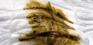 Meddygfa Bumwipe Neoliberal